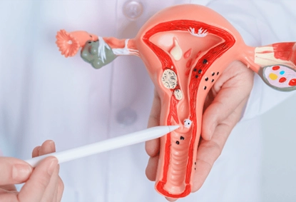 Ovarian Cyst Removal Surgery in India: Laparoscopic Procedure, Cost & Recovery Details